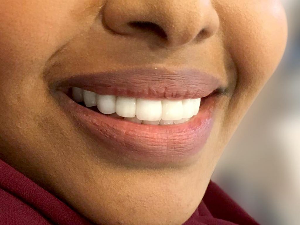 Netizens Speak Out Against Whitening Teeth Product That's ...